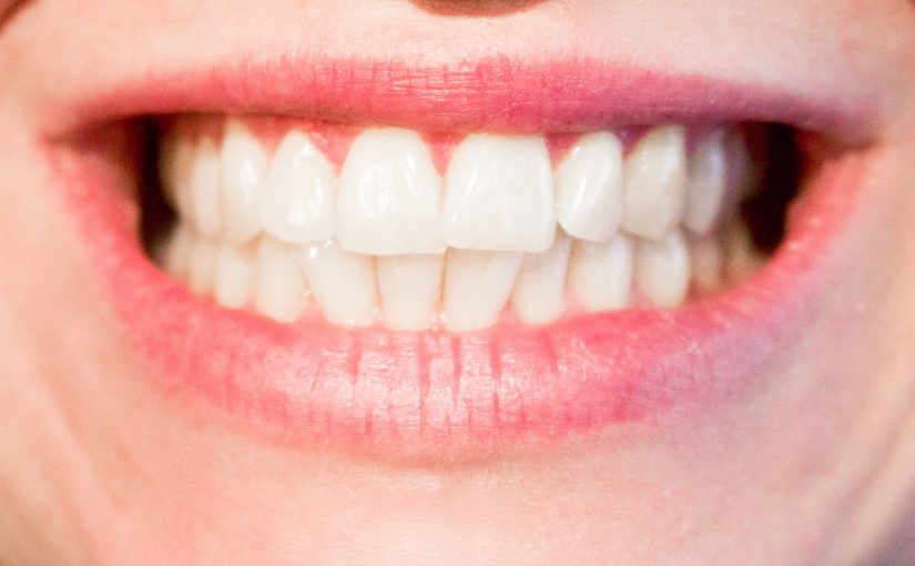 Obecna technologia używana w salonach stomatologii estetycznej być może spowodować, że odbierzemy prześliczny uśmiech.